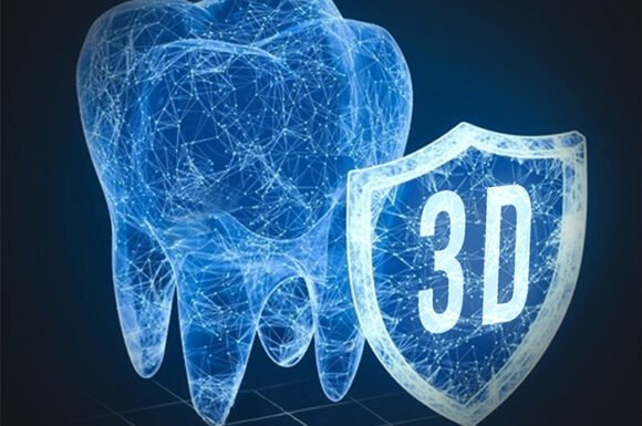 3D Kılavuzlu İmplant